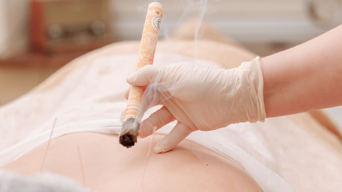 Bâtonnet de moxa chauffant des points d’acupuncture pendant une séance
